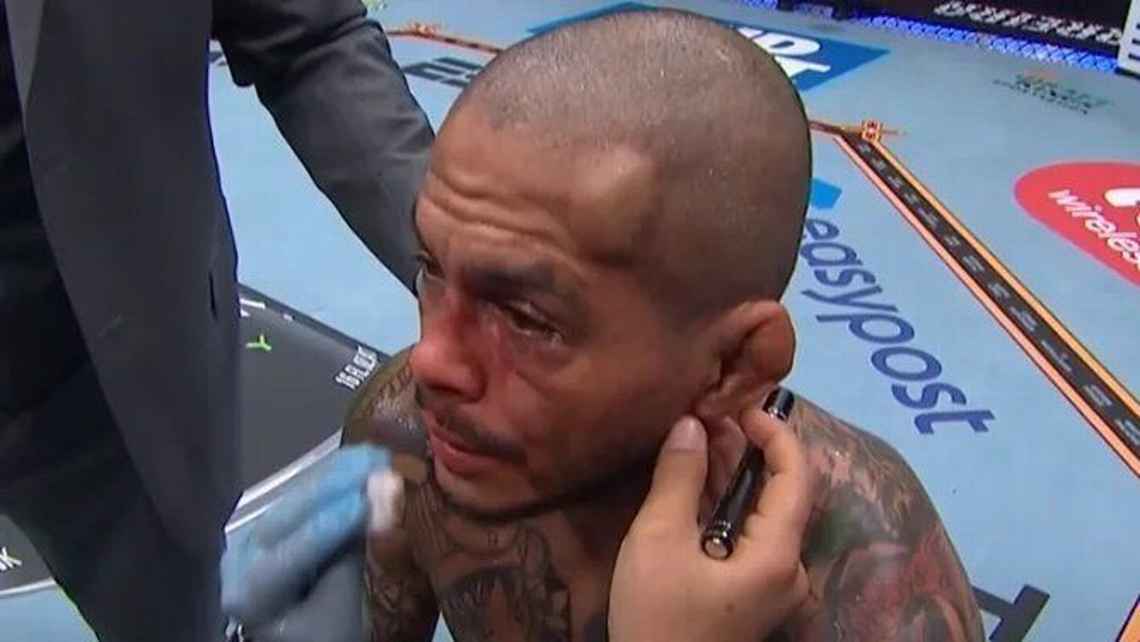 Lutador deixa brasileiro com galo na testa em nocaute insano no UFC Noche